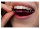 Orthodontic Retainer Replacement in Charlotte, NC