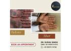 Best Solutions Skin Specialist in Behala Dr Sushil Singh