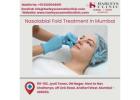 Nasolabial Fold Treatment in Mumbai | Subtle, Lasting Results
