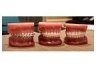  Transform Your Smile with a Trusted Charlotte Orthodontist