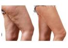 Body Fat Reduction - Sculpt Your Body