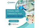 Primary Cells Tailored to Your Research Needs