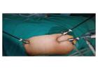 Top Hospital for Laparoscopic Gallbladder Surgery in Kolkata – Genesis Hospital