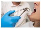 Best Implant Center in Goa