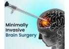 Best Neurosurgeon Noida