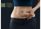 Transform Your Look with Expert Plastic Surgery in Ghana 