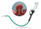 Leading Bariatric Endoscopy Treatment in Ludhiana – Dr. Nitin Behl