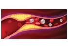 EECP Therapy for 80-90% Blockage: Can It Help You Avoid Bypass Surgery?