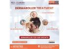 Best Advance Scar Revision Treatment in india