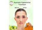 How to Treat Pigmentation Naturally with Ayurveda ~Restore Radiance the Ancient Way