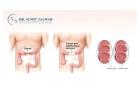 Advanced Colorectal Treatments by DrSumitObesityCare