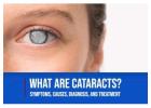 Cataracts: Causes, Symptoms & Effective Treatments