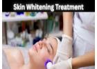 Advanced Skin Whitening Treatments in Mumbai by Gloss Clinic
