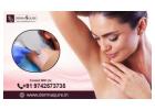 Permanent Laser Hair Removal in Bangalore