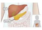 Top Bariatric Endoscopy Care in Punjab – Dr. Nitin Behl