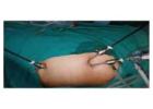 Genesis Hospital Kolkata – Trusted for Expert Healthcare