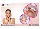 Best Uneven Skin Tone Treatment in Bangalore