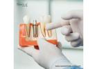 Top Dental Implant Manufacturers in Peru with Quality Products