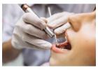 Teeth Cleaning Cost in Ahmedabad