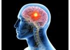 Brain Surgery in India