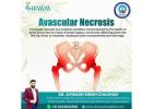 Best Ayurvedic Medicine for Avascular Necrosis – Shivaya Hospital