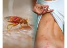 100% Effective Bed Bug pest control in mumbai – Book Now