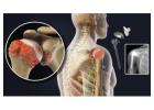 Regain Shoulder Strength with Total Shoulder Replacement Surgery in Delhi