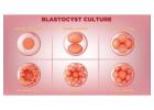 Affordable IUI Cost & Expert Specialists  Best IUI Centres in Bangalore 