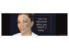 Say Goodbye to Stubborn Pigmentation, Best Melasma Treatment in Thane