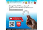 Affordable Invisalign Clear Aligners in Nellore with Free 3D Smile Scan