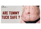 Tummy tuck (abdominoplasty) in delhi with best surgeon