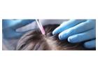 Hair Transplant