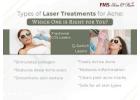 Say Goodbye to Acne Marks: How to Pick the Perfect Laser Treatment