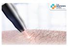 Say Goodbye to Unwanted Hair with Laser Hair Removal 