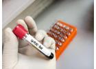 Top 10 Blood Tests for Heart Patients in Non-Surgical Heart Disease Treatment