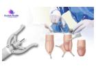 Best Circumcision Surgery Cost in Bangalore at Orchidz Health