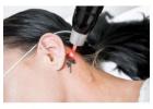 Refresh Your Look at Leading Aesthetic Laser Centre Envy Aesthetics