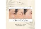 Rejuvenate Your Skin with Advanced Wrinkle Solutions