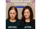 Human Hair Patches at Hair Fixing Zone Bangalore