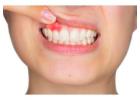 Dental clinic in pimple gurav | Dentist in pimple gurav, Pune | Ekdant Dental Care
