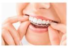 Braces | Dental Braces Treatment in Pimple gurav, Pune | Ekdant Dental Care