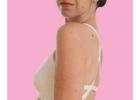 Skin Tag Removal Treatment Near Me