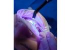 Perlau Gwyn Dental Care – Trusted Teeth Whitening Clinic in Cardiff for Radiant Smiles