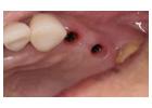 Transform your smile and appeal with steadfast Cosmetic dentist in Tijuana