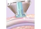 Energlo Sets New Standards in Exfoliating Machine for Face