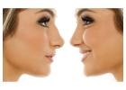"Result-Specific Rhinoplasty Surgery by Dr. Lokesh Handa at Med Esthetiks "
