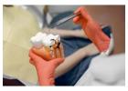 Expert Root Canal Treatment Near You – Restore Your Smile with Pleasant Dental