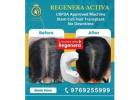 best Hair Transplant in Thane by DNA Royal Aesthetic Clinic.