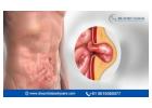 Best Doctor for Complex Abdominal Hernia Surgery in Bangalore