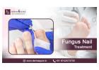 Effective Fungus Nail Treatment in Bangalore